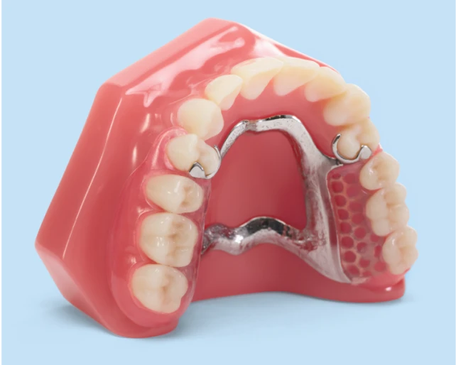 Aspen Dental partial dentures. 
