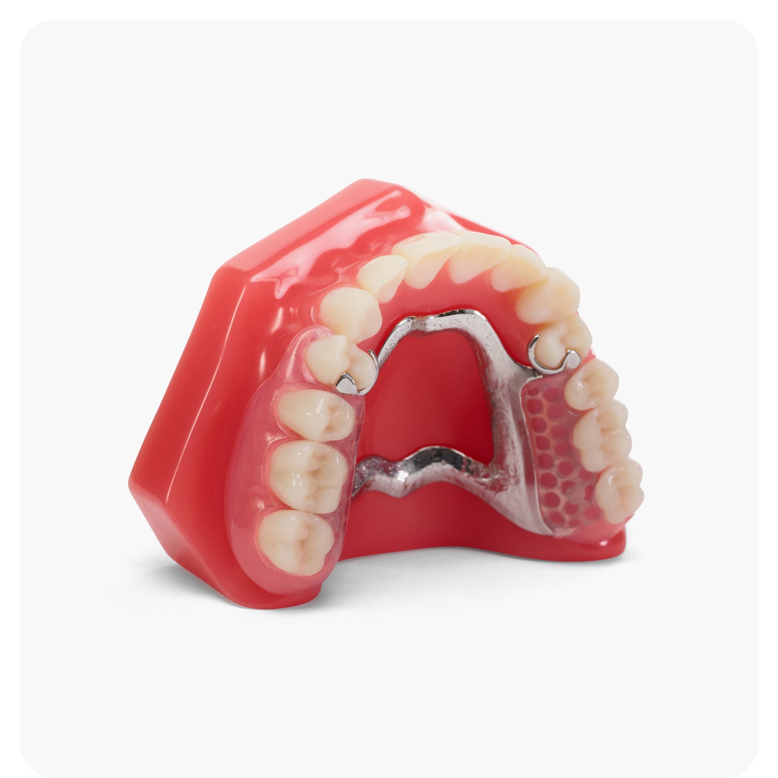 A premium Aspen Dental hybrid partial denture model featuring a metal and resin frame with hidden clasps, designed for a secure and comfortable fit, displayed on a red gum model.