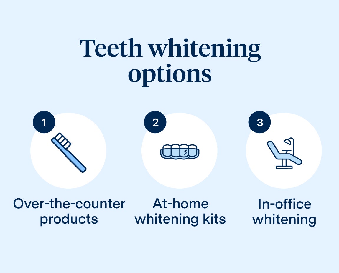 A graphic displaying three teeth whitening options: over-the-counter products, at-home whitening kits, and in-office whitening treatments, illustrating choices for achieving a brighter smile.