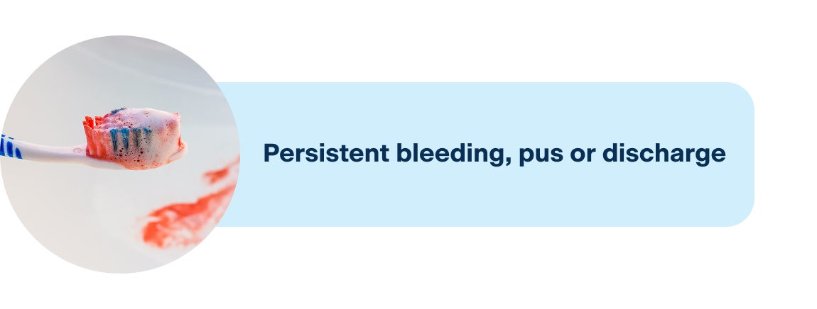 An image showing one of the common symptoms of an infected implant, including persistent bleeding, pus, or discharge.