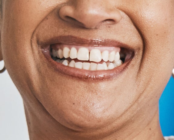 A healthy and confident smile highlighting the positive results of dental treatment from Aspen Dental.