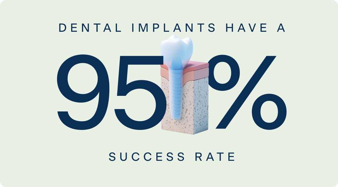 Graphic highlighting that dental implants have a 95% success rate, with an illustration of a tooth and implant structure, representing ClearChoice services.