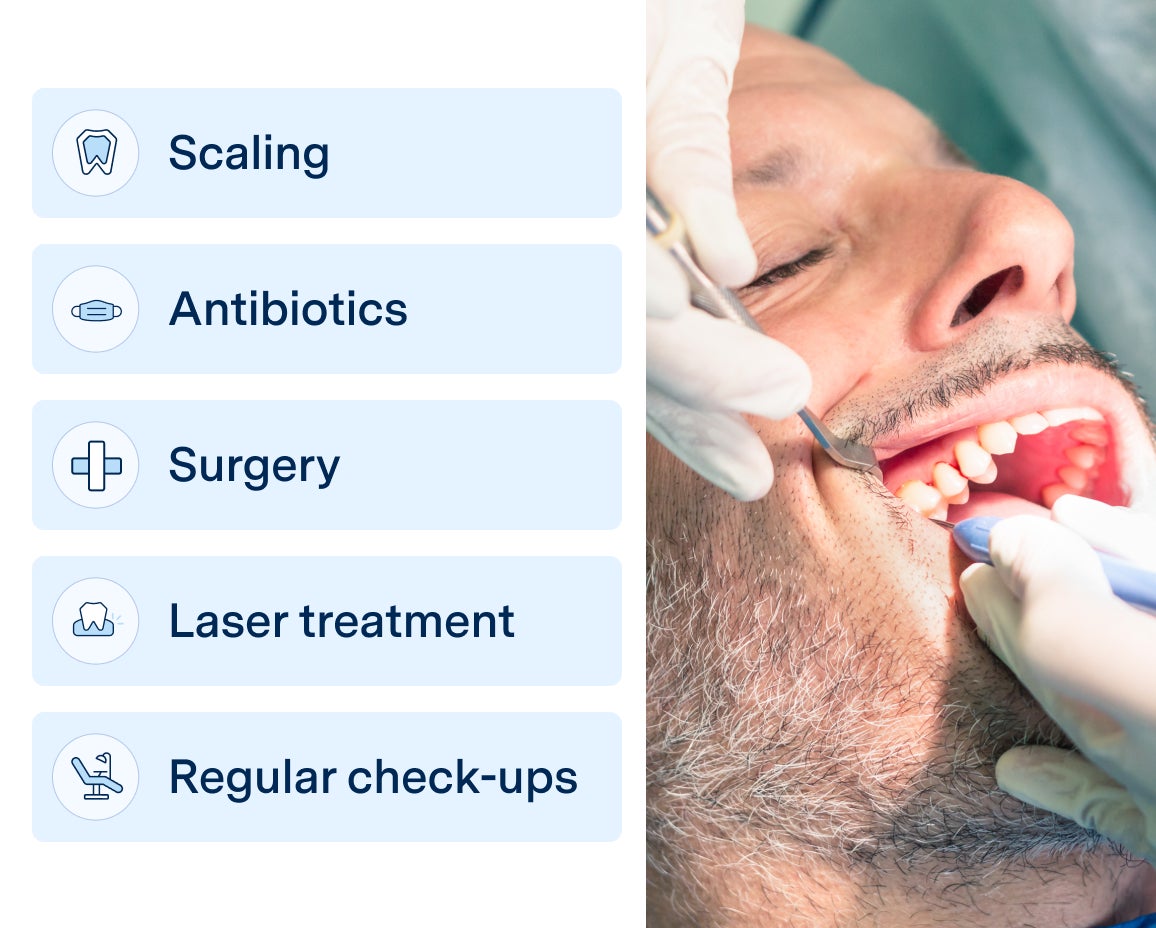 Dental professional performing treatment on a male patient, with a list of gum disease treatment options including scaling, antibiotics, surgery, laser treatment, and regular check-ups for Aspen Dental.