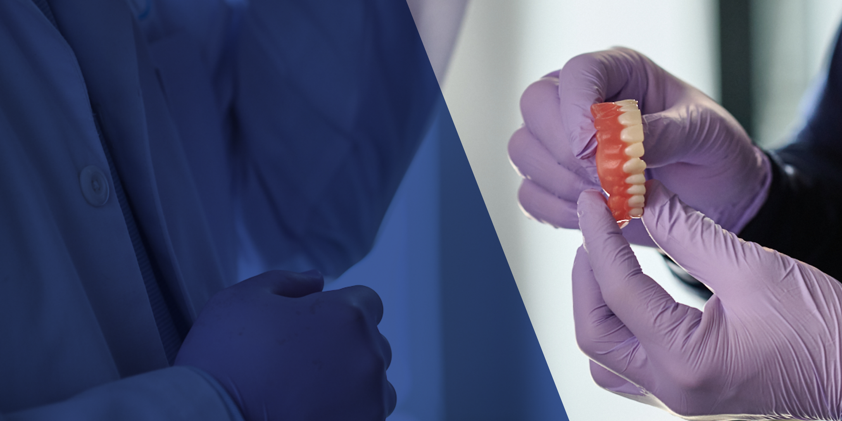 Relining Dentures and Denture Reline Near You