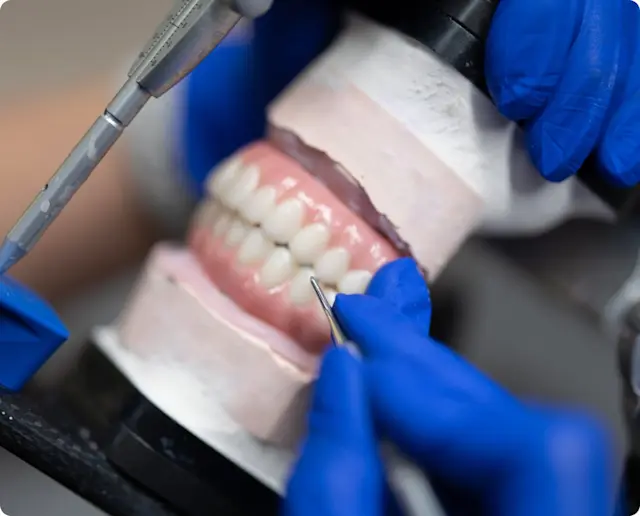 Dental Implant Crowns: Understanding the Types and Procedure | ClearChoice