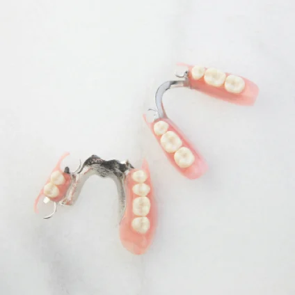 Aspen Dental partial dentures.