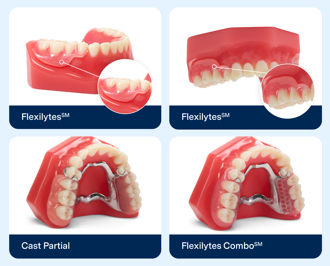 A collage showing four different types of denture models. Top left is labeled "Flexilytes℠ showcasing the lower denture, and top right is also labeled "Flexilytes℠ showcaing the upper denture, where both highlight natural looking feature of the denture. Bottom left is labeled "Cast Partial," showcasing dentures with metal frame and bottom right image is labeled "Flexilytes Combo℠," showcasing a blend of natural looking teeth and strength with metal frame.