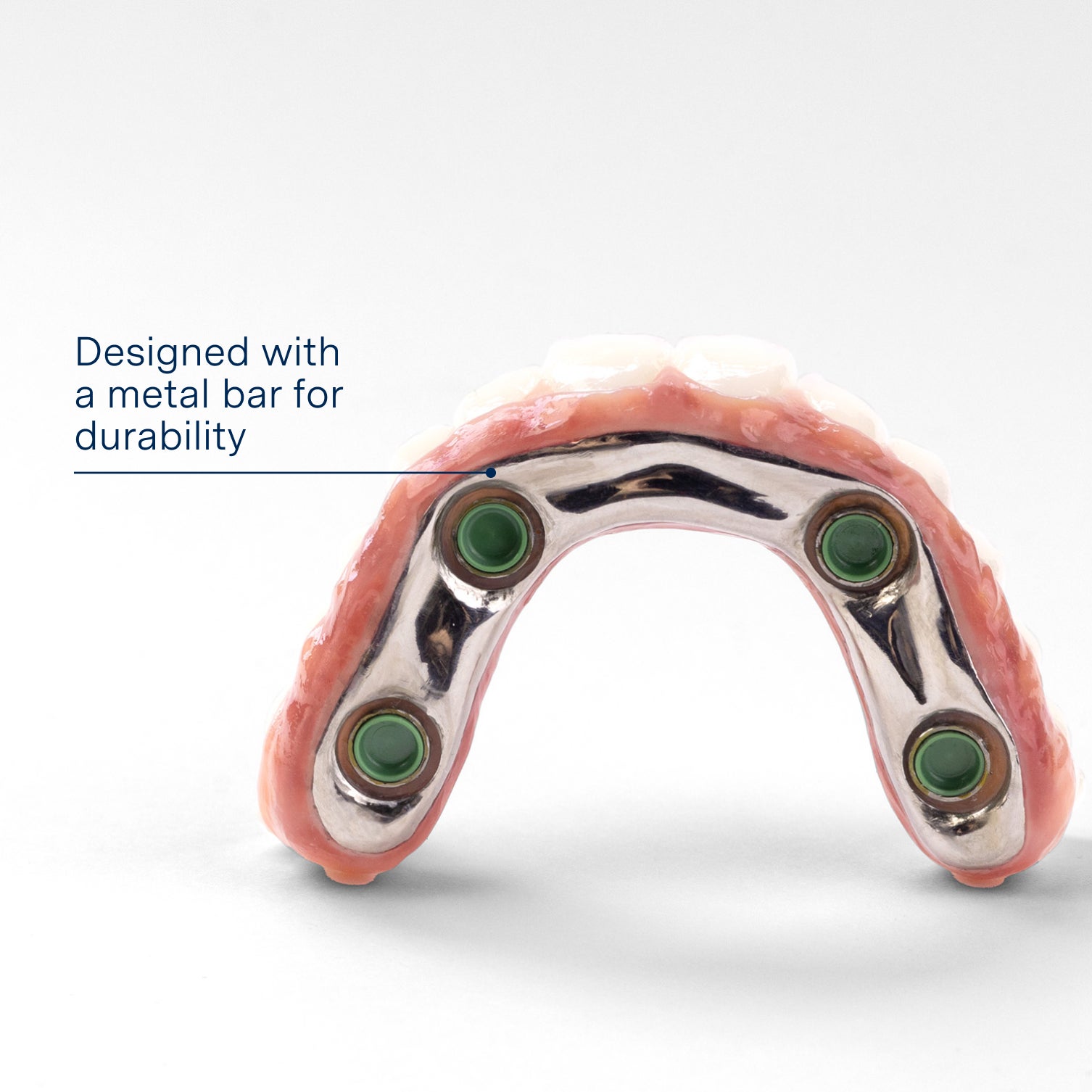 A full-arch dental implant prosthesis featuring a durable metal bar for enhanced strength and stability. This design ensures long-lasting support and a secure fit for improved oral function and comfort.


