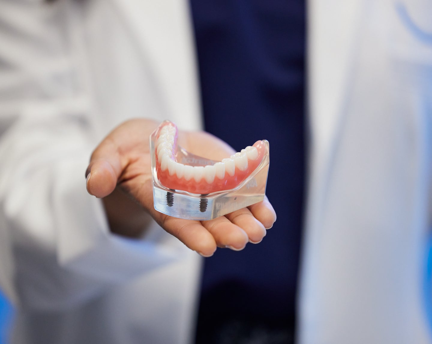 Implant Dentures Cost &amp; Pricing | Affordable Options at Aspen Dental