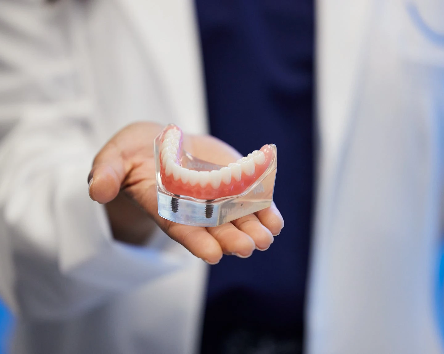 Implant Dentures Cost & Pricing | Affordable Options at Aspen Dental