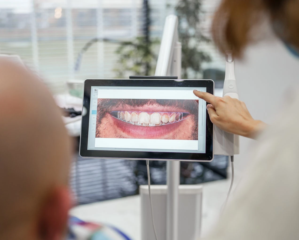 ClearChoice dentist showing a before picture during a virtual smile design consultation.
