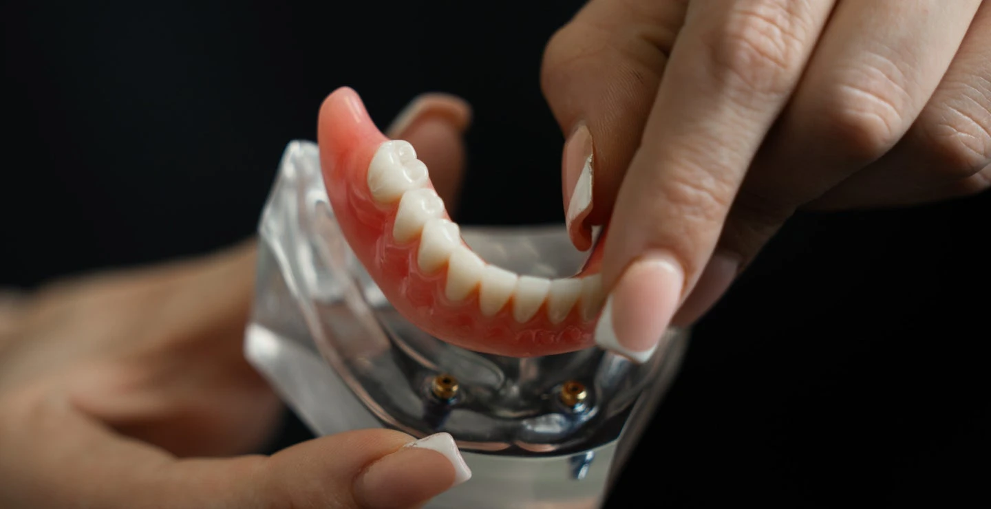 Close-up of hands holding a ClearChoice implant-supported denture model, showcasing the attachment mechanism on a black background.