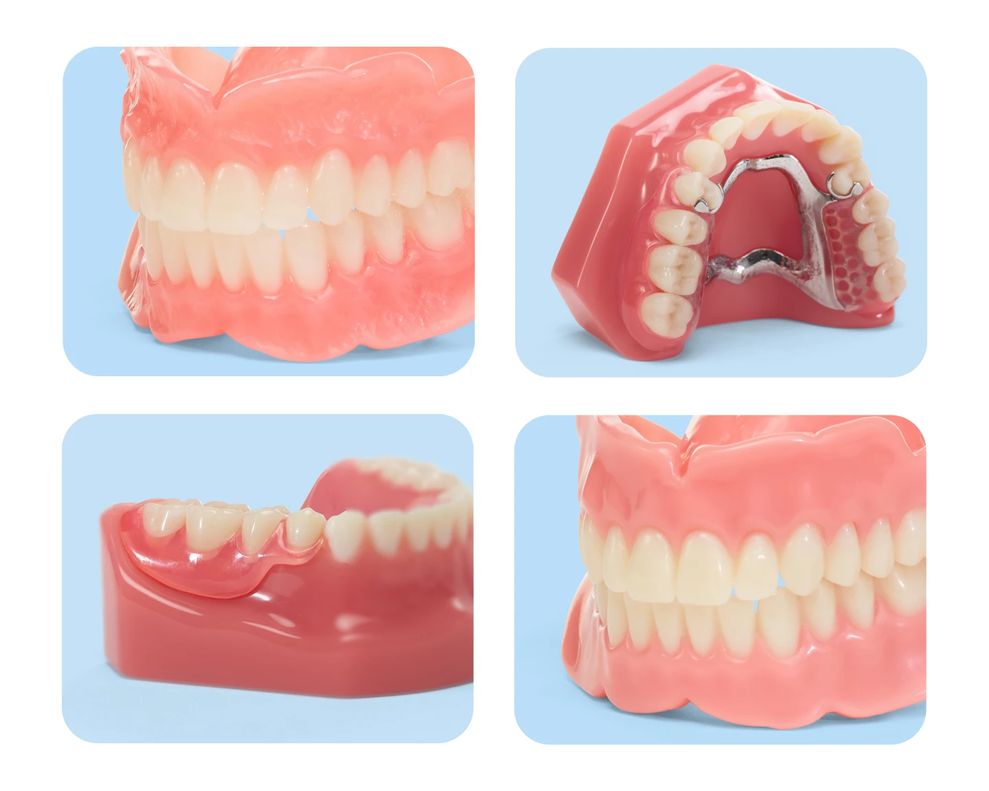 Types of Dentures at Aspen Dental