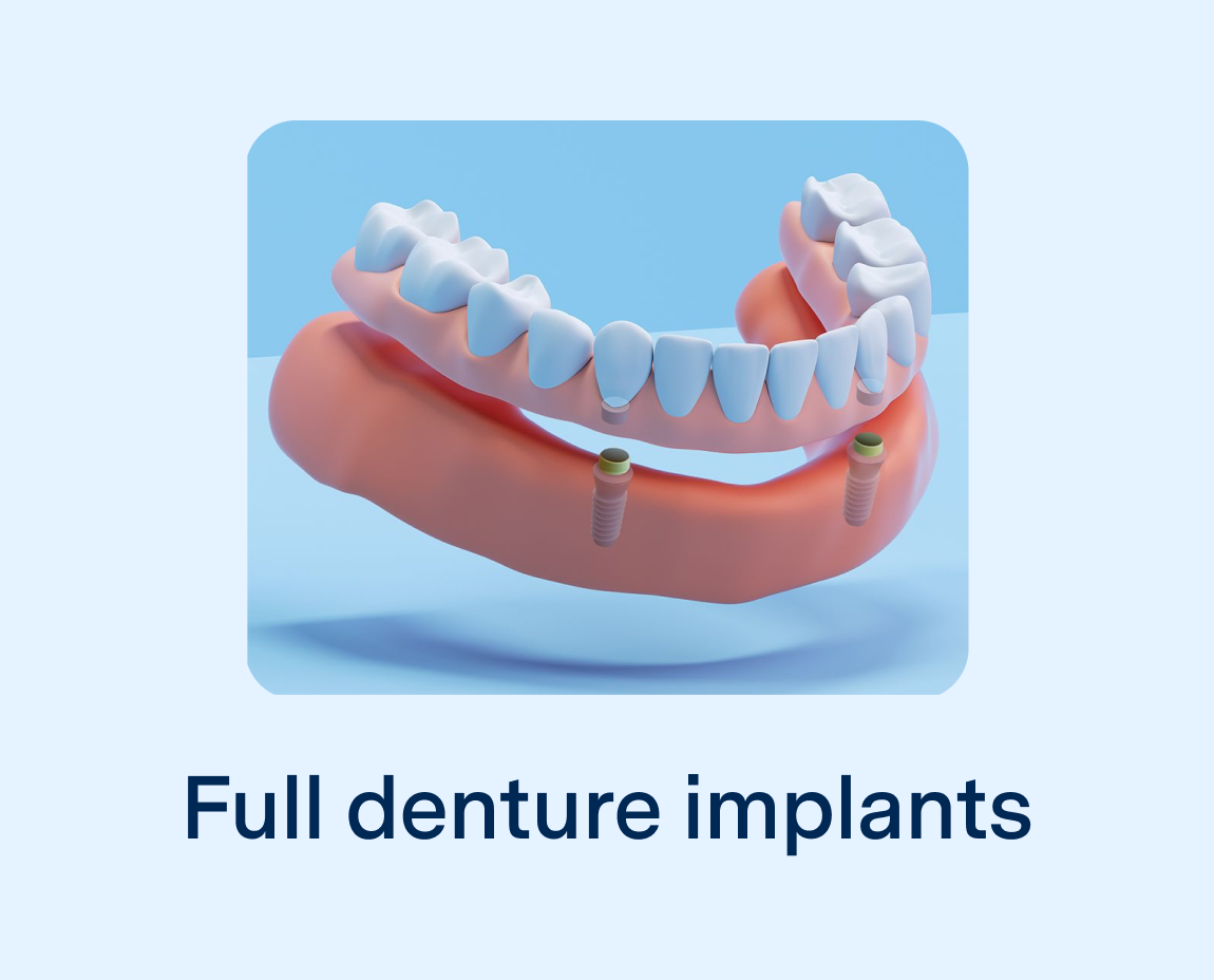 A graphic showcasing full lower denture with implants on light blue background with the words 'Full denture implants'.
