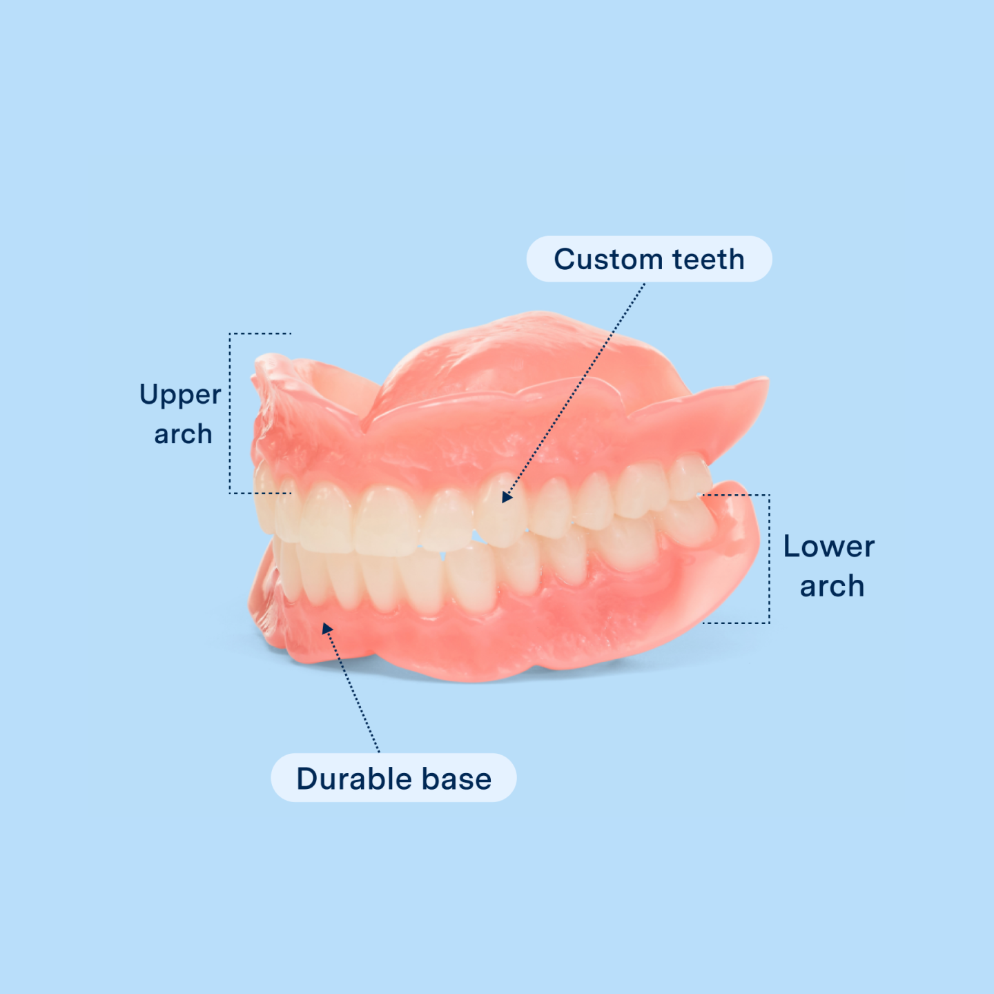 A graphic displaying elements of Aspen Dental dentures such as custom teeth, upper/lower arch , and durable base. 