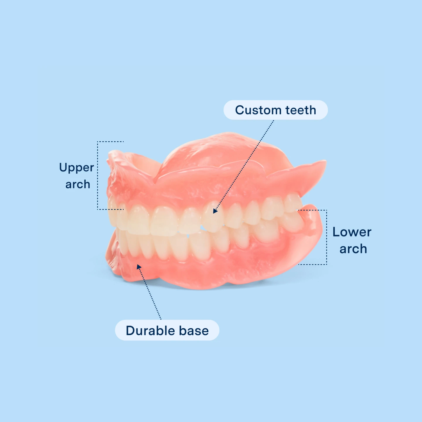 A graphic displaying elements of Aspen Dental dentures such as custom teeth, upper/lower arch , and durable base. 