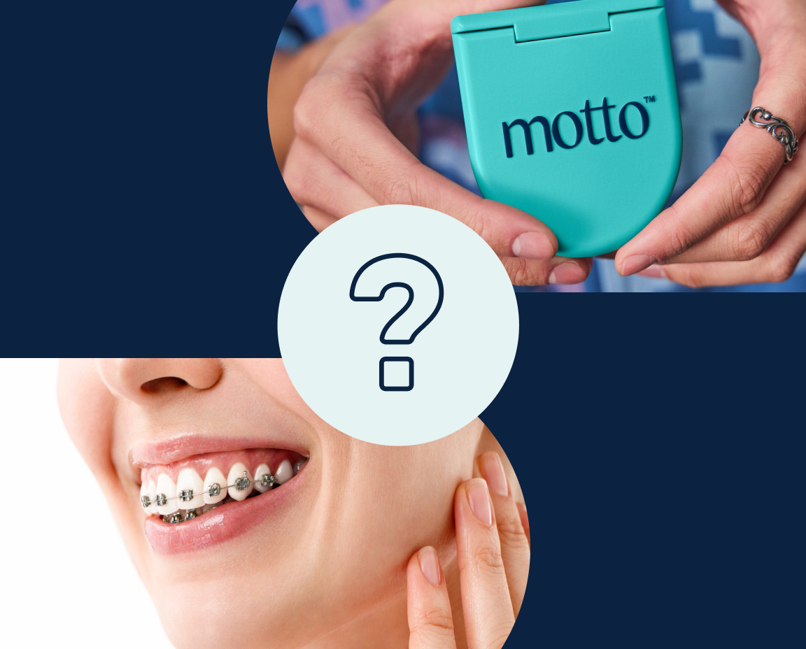 Collage of a smile with metal braces, Motto aligners case, and a question mark.