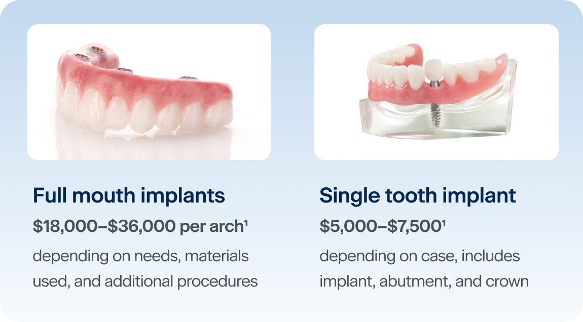 An image comparing the cost between full mouth implants and a single tooth implant. Full mouth implants may cost between $18,000 to $36,000 per arch, depending on needs, materials used, and whether additional procedures are needed. A single tooth implant may cost between $5,000 to $7,500, depending on case, and includes the implant, abutment, and crown.