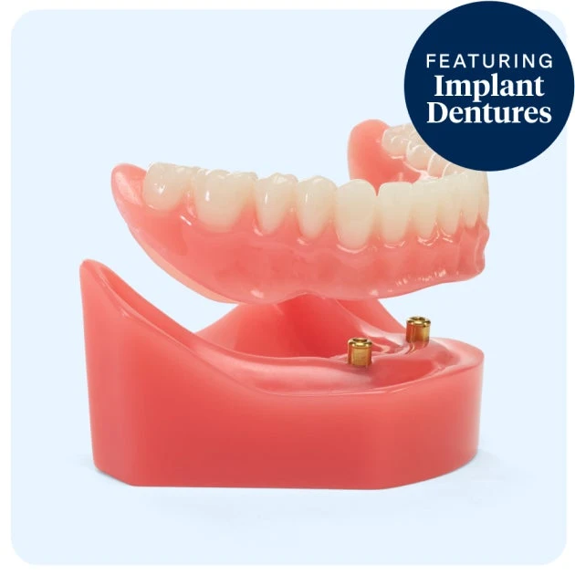 Aspen Dental implant dentures.