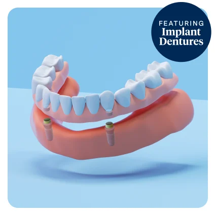 Aspen Dental implant dentures.