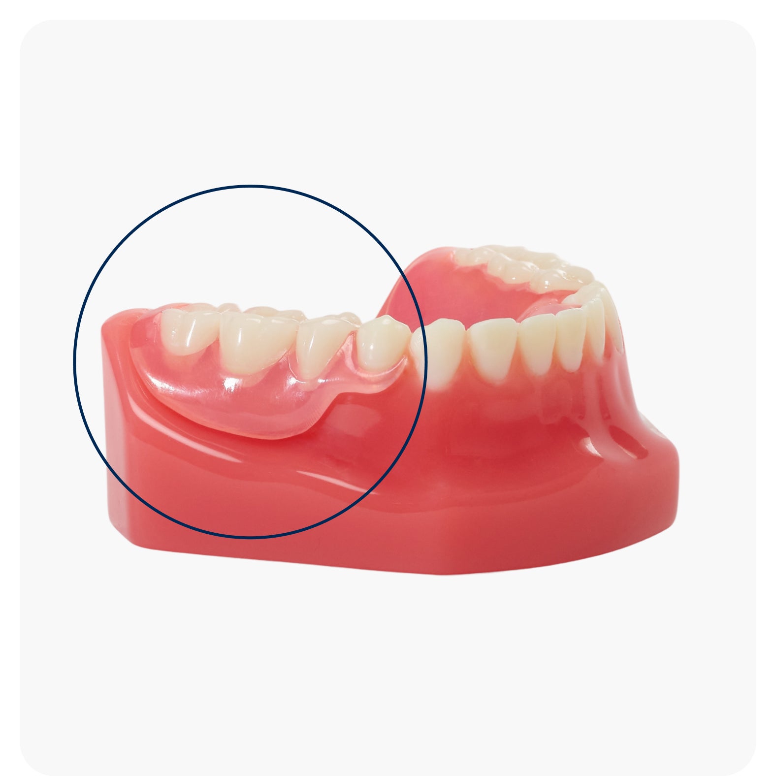 A natural-looking partial denture with life like teeth and gum-colored material, designed to blend seamlessly with existing teeth for an aesthetic smile.