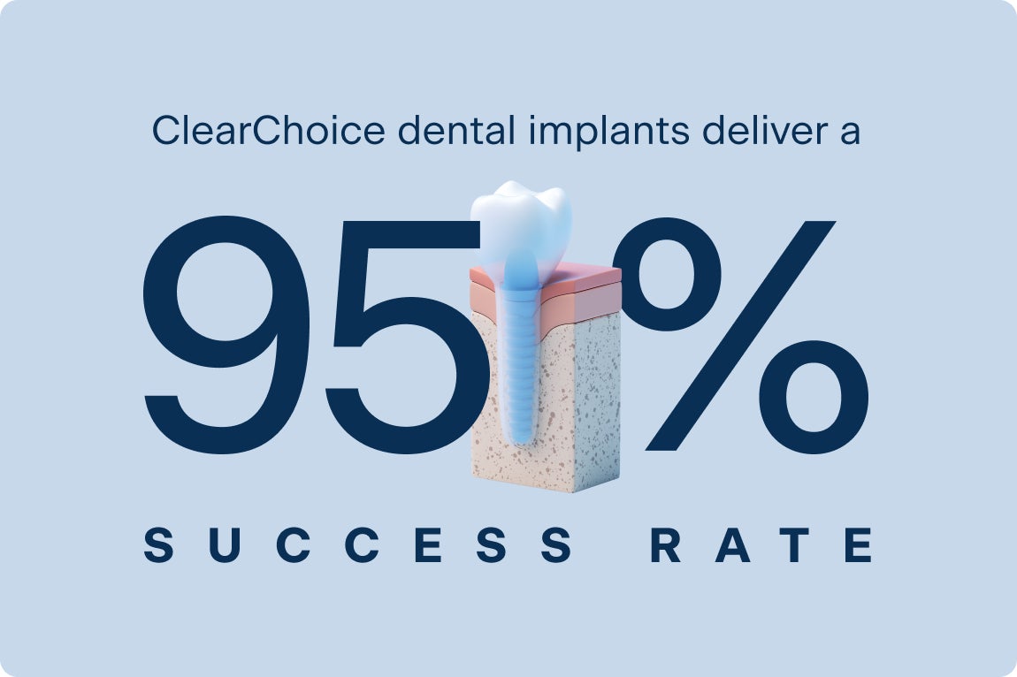Graphic showing a dental implant with text stating “ClearChoice dental implants deliver a 95% success rate,” reinforcing treatment reliability and patient outcomes.