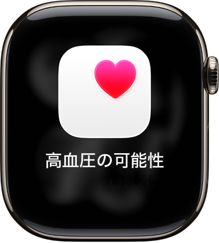 apple watch 03