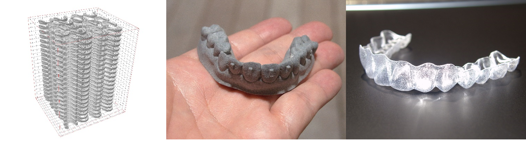 ヤマト運輸株式会社、3Dプリンターを活用した国内初の歯科矯正マウスピースのオンデマンド生産・配送サービスを開始