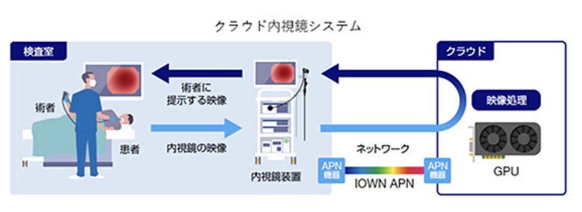NTTとオリンパス、世界初のクラウド内視鏡技術―150km離れた診断で遅延1.1msを実証