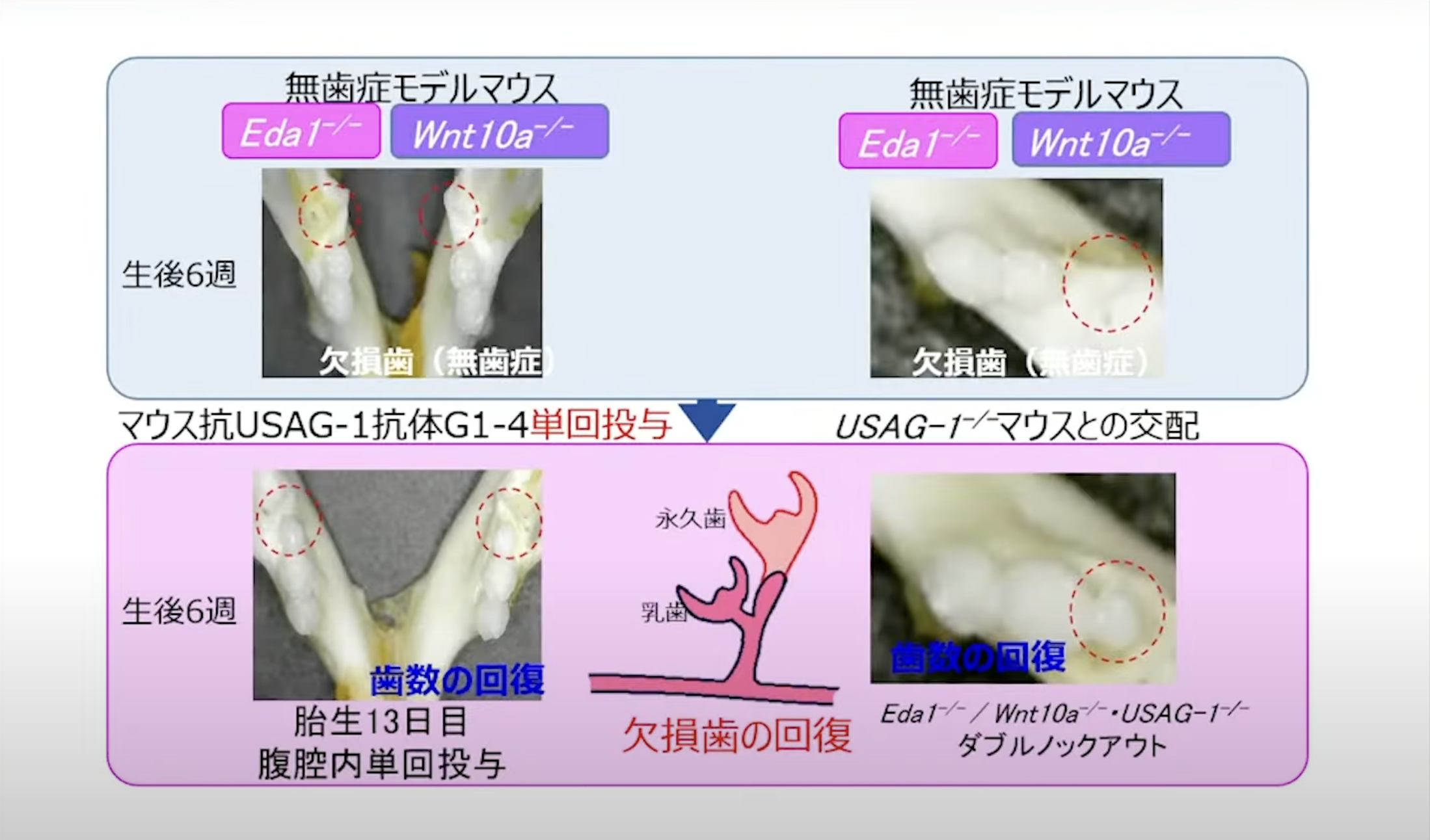 北野病院　歯生え薬