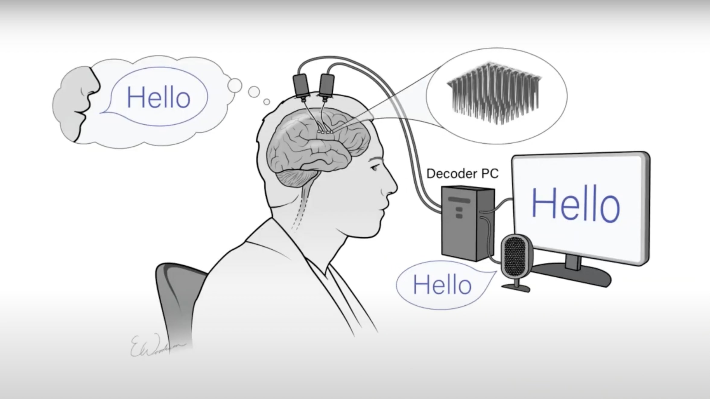 スタンフォード大学、音声脳インターフェイスで「分速62語」のコミュニケーションを達成─最高記録の3倍の語数