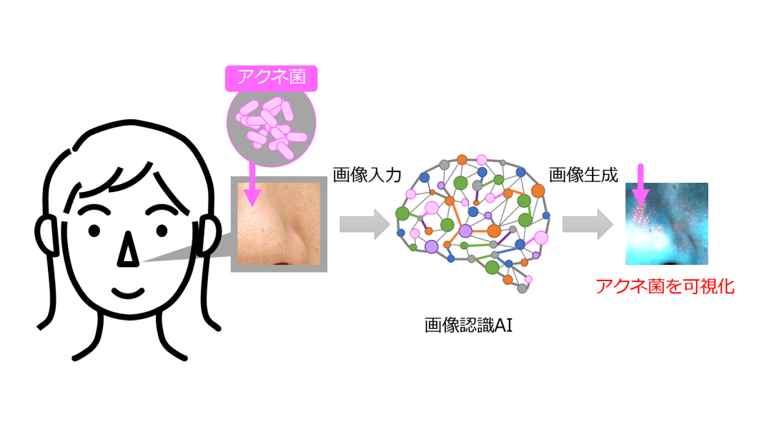 ライオン、画像認識AIでニキビの原因菌を可視化する技術を開発―東京電機大と共同研究、スマホ展開も想定