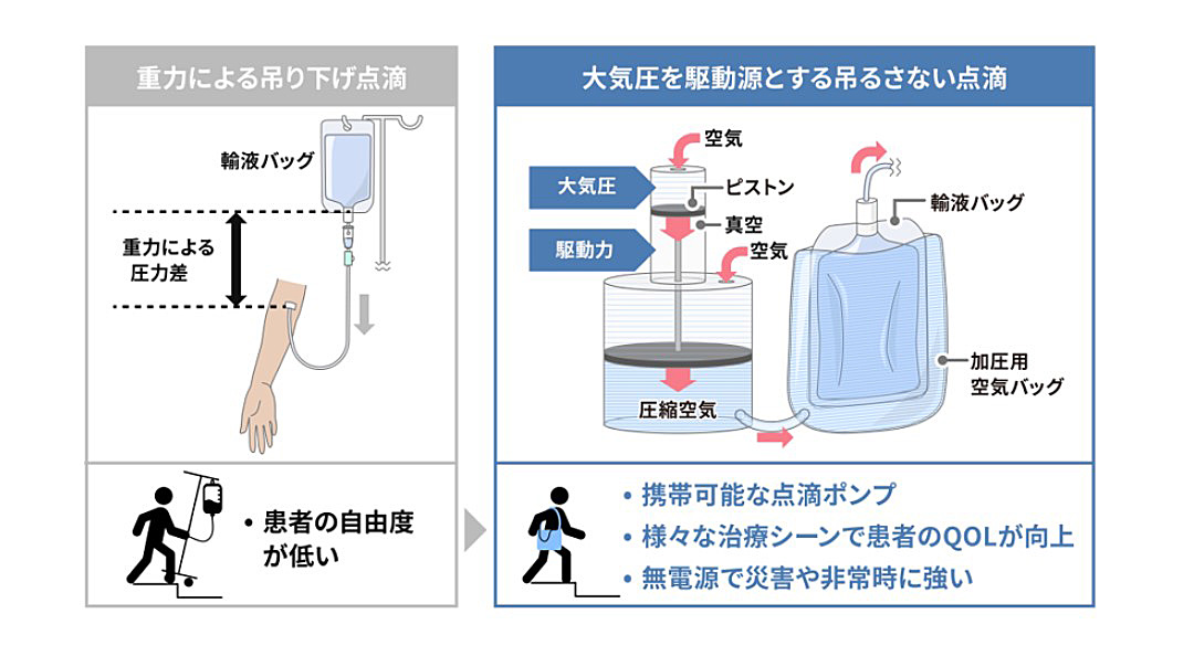 吊るさない点滴_sub