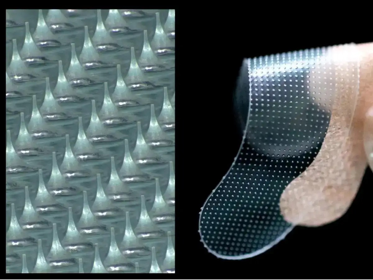 「皮膚に含まれる成分」でできた針が皮膚内で溶ける技術