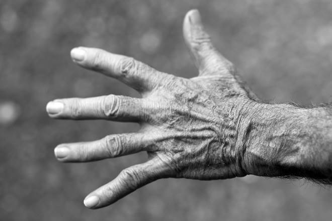 rheumatoid-arthritis-causes