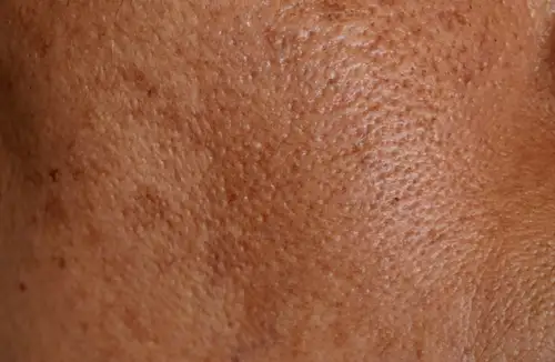 Uneven Tone