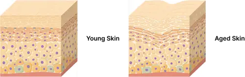Young skin vs Aged skin