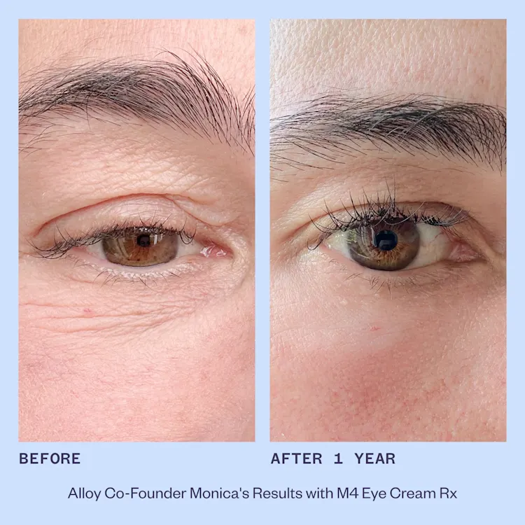 Monica Before & After