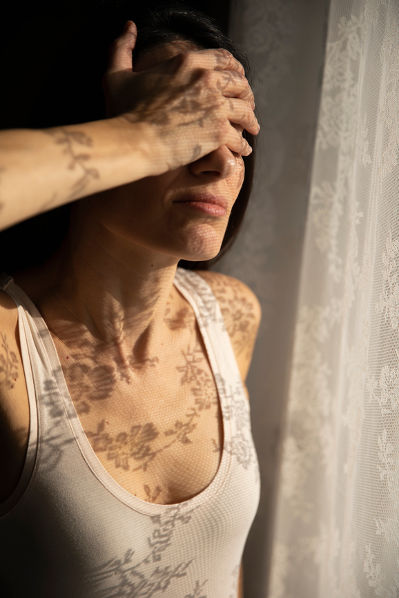 AW277 Does Menopause Cause Fatigue? (photo of a woman covering her eyes with her hand in exhaustion next to lace curtained window with morning light pouring in)