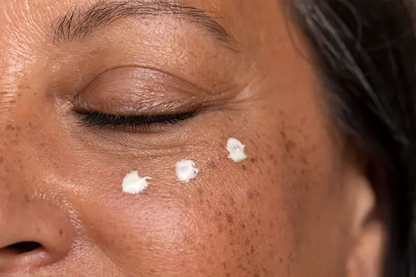 AW578 close up of Latin woman with freckled wearing three dots of eye cream under her closed eyes. thumbnail