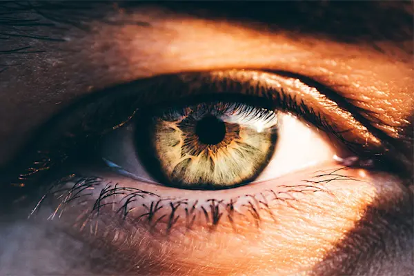 Close-up photo of a woman's green eye in the sunlight. thumbnail