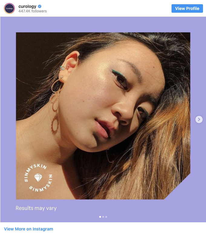 Instagram photo from Curology account of closeup of woman