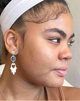 Fanny - After 2 months