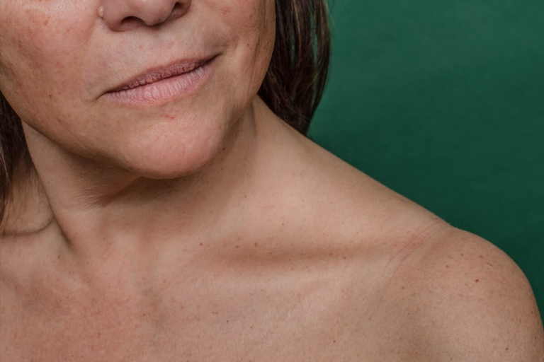 Closeup of bottom half of face and bare collarbone and shoulder of woman against a green background