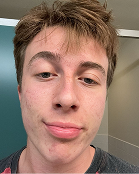 Mark - After