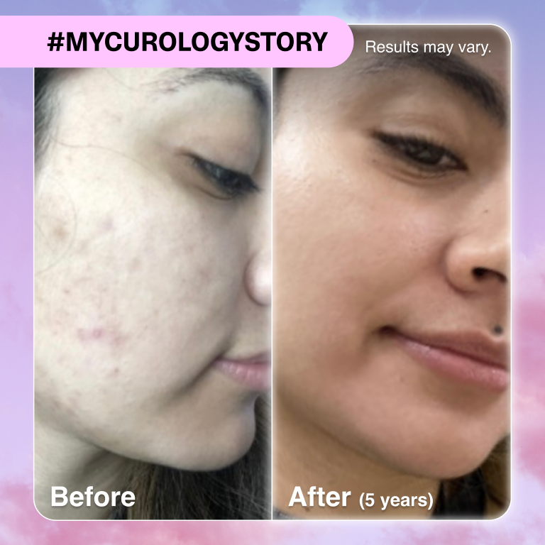 Alexis B&A
