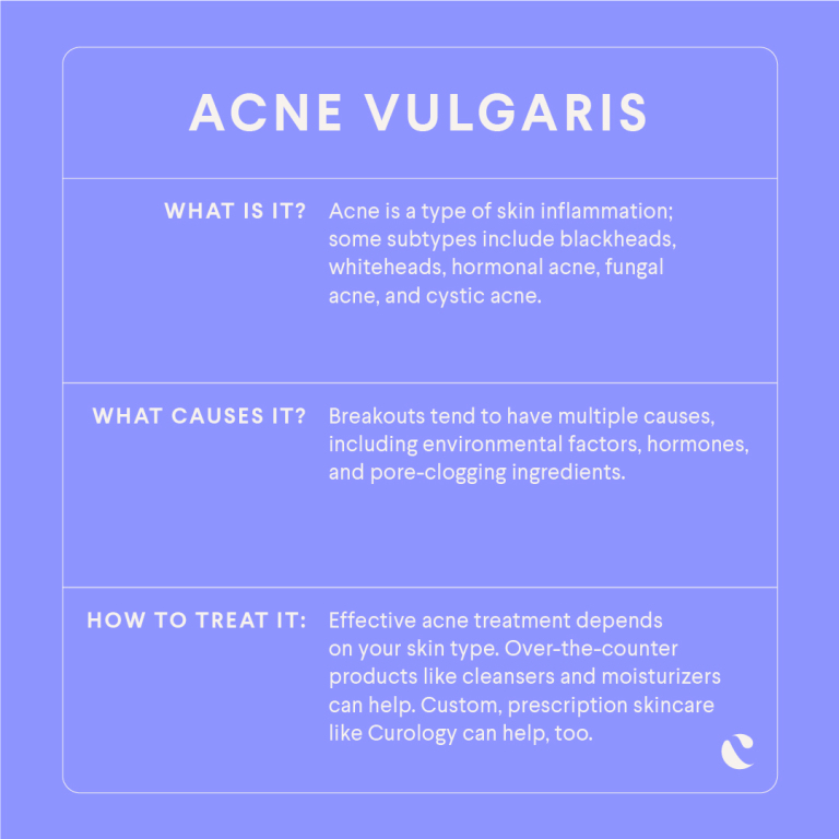 Everything You Need To Know About Acne Infographic