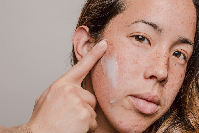 Closeup of woman's face and hand applying cream