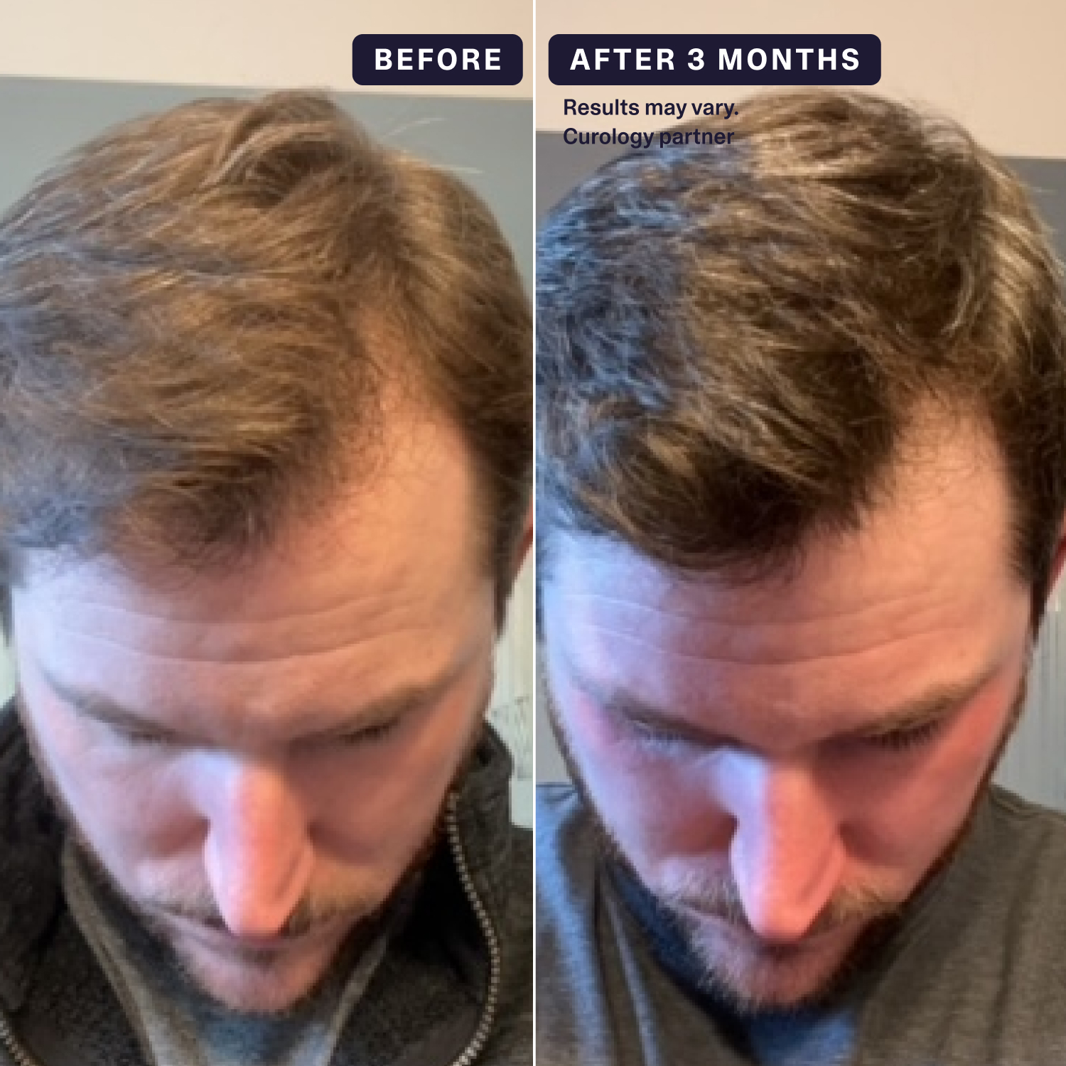 curology-hair-formula-rx-image-4