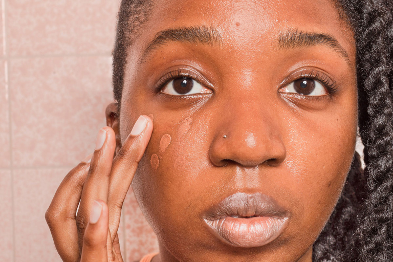 concealers acne prone skin 3